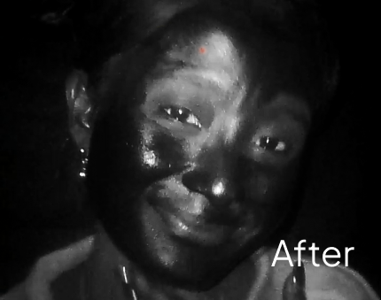 after (5)