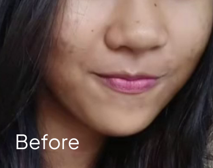 before (4)